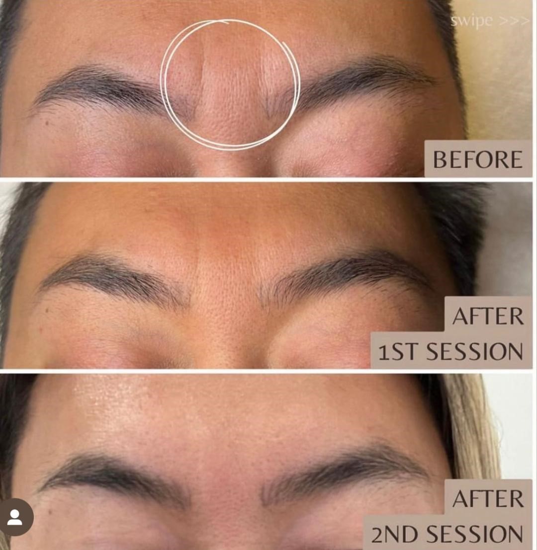 Microchanneling Salon De Christe Cottleville + Saint Charles, MO